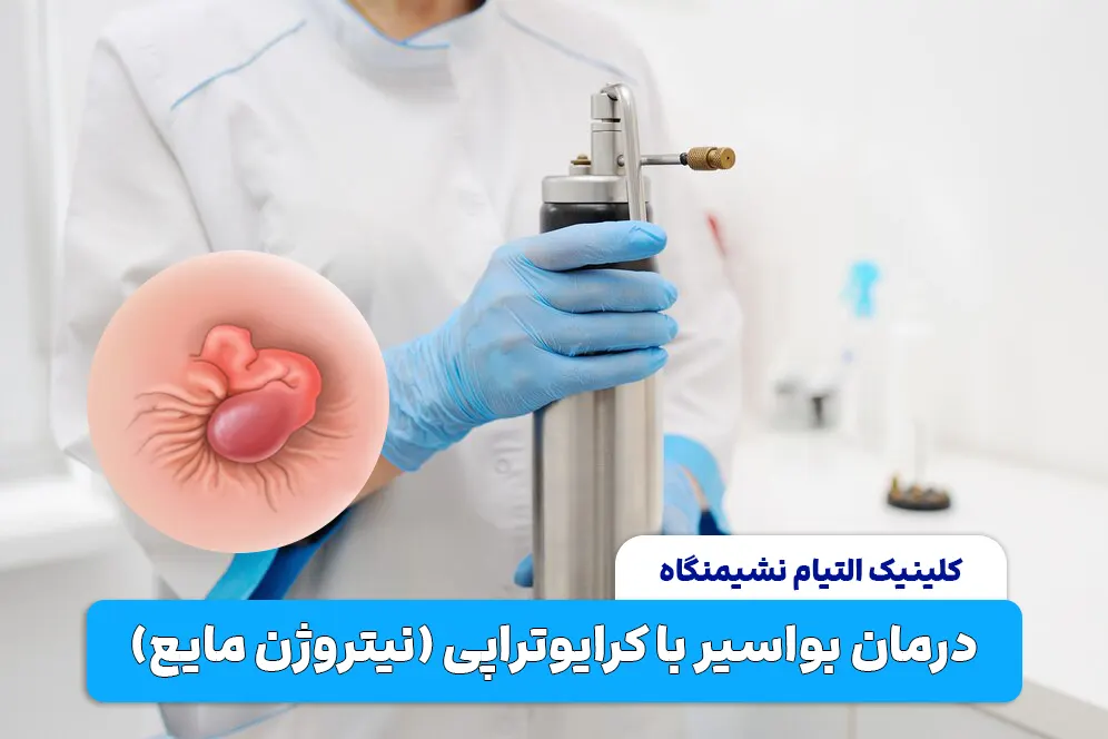 کرایوتراپی برای درمان بواسیر
