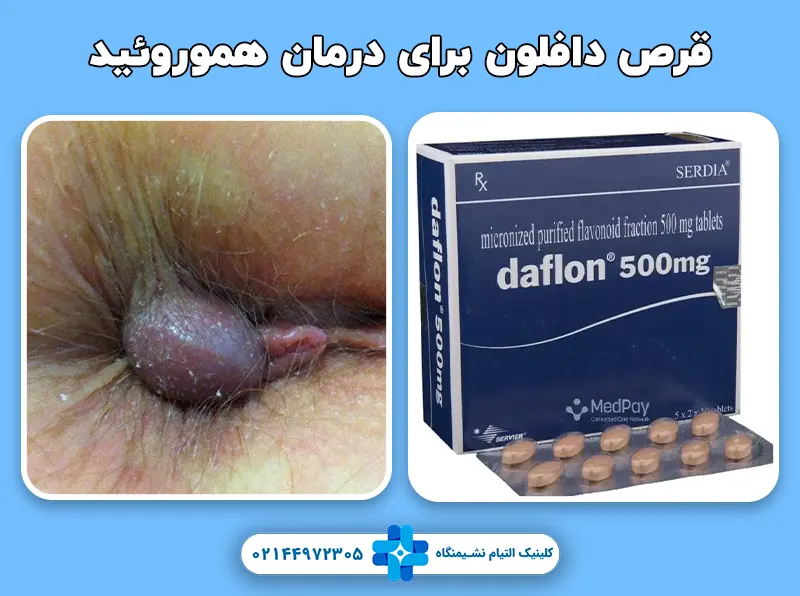 قرص دافلون برای درمان هموروئید