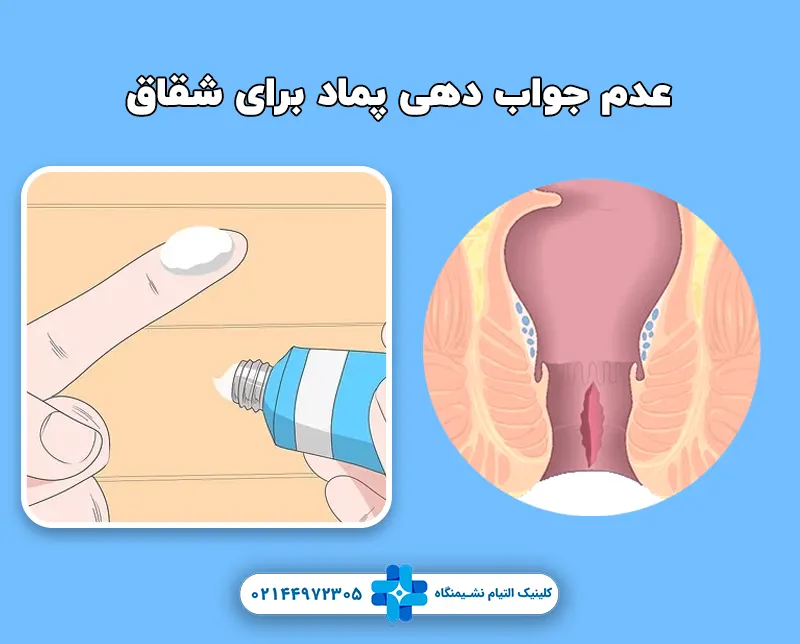 عدم جواب دهی پماد برای شقاق
