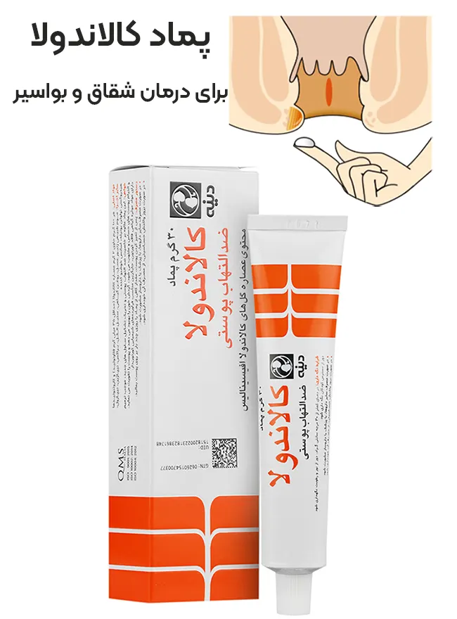 پماد کالاندولا برای درمان شقاق و بواسیر