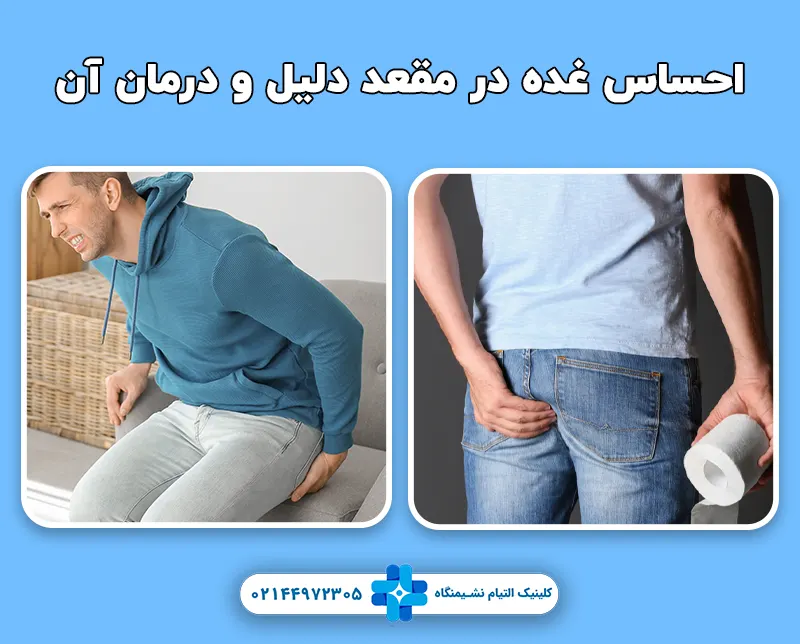 غده در مقعد