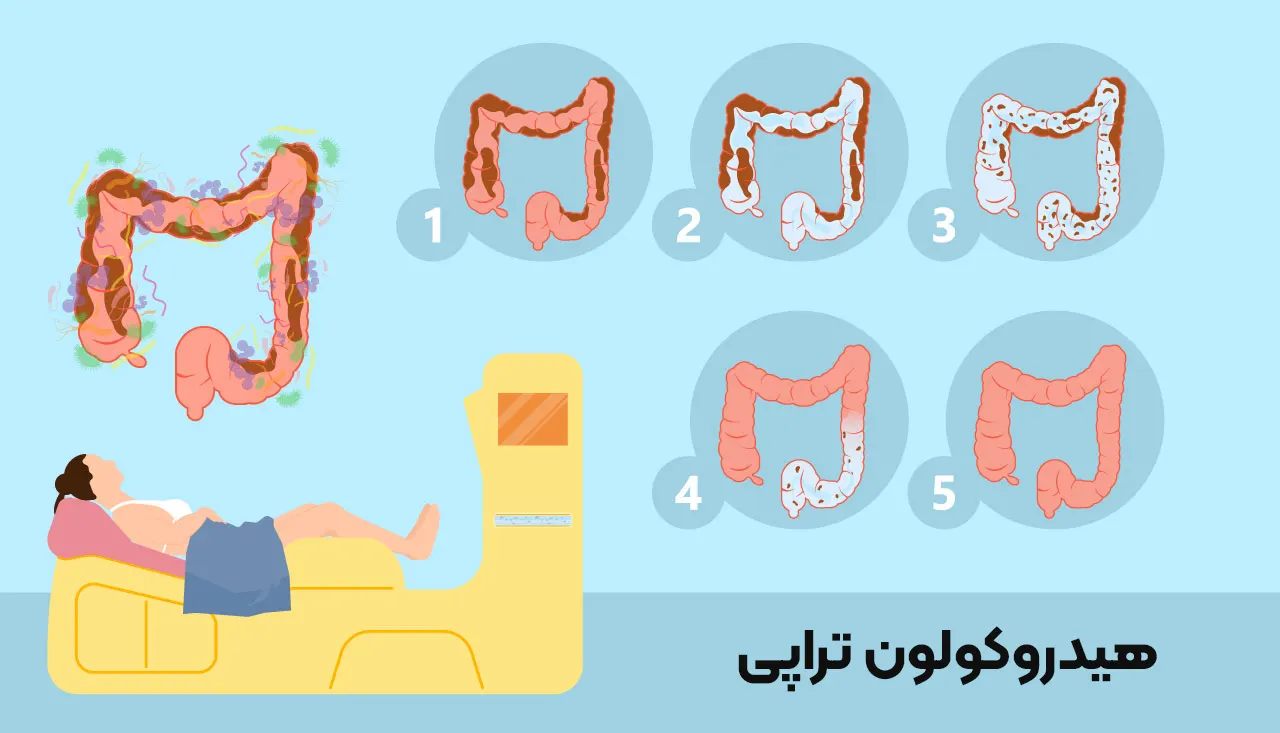 هیدروکولون‌ تراپی