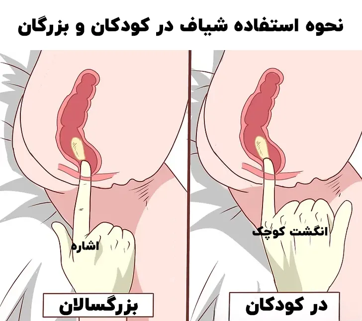 نحوه استفاده شیاف گلیسرین در کودکان و بزرگسالان