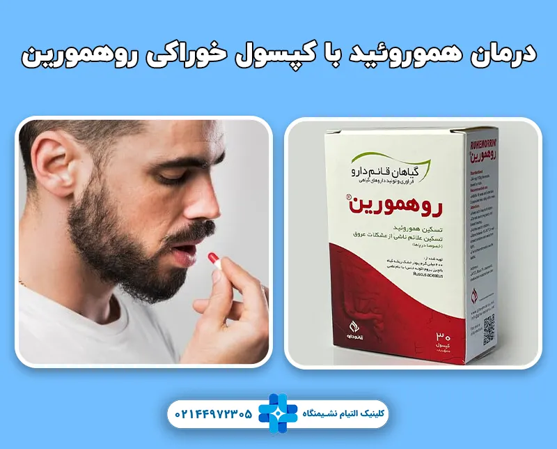 درمان هموروئید با کپسول خوراکی روهمورین
