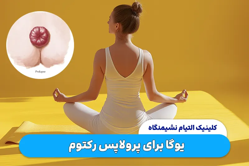 تأثیر یوگا در بهبود پرولاپس رکتوم