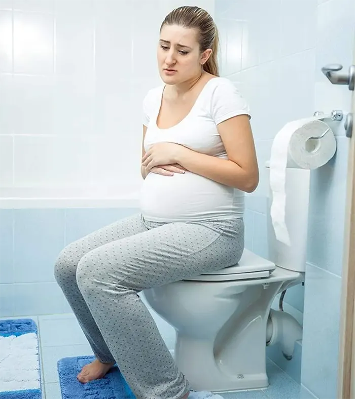 یبوست در بارداری