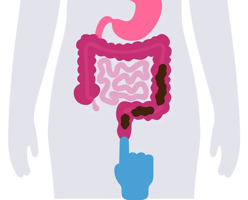 رفلاکس مدفوع