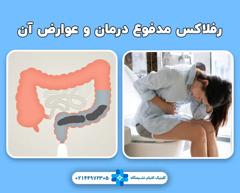 رفلاکس مدفوع