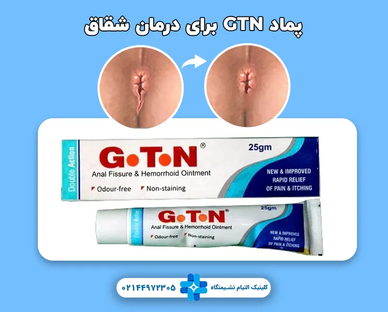 پماد GTN برای درمان شقاق