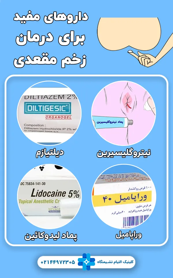 داروهای مفید برای درمان زخم مقعدی