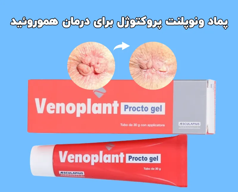 پماد ونوپلنت پروکتوژل برای درمان هموروئید