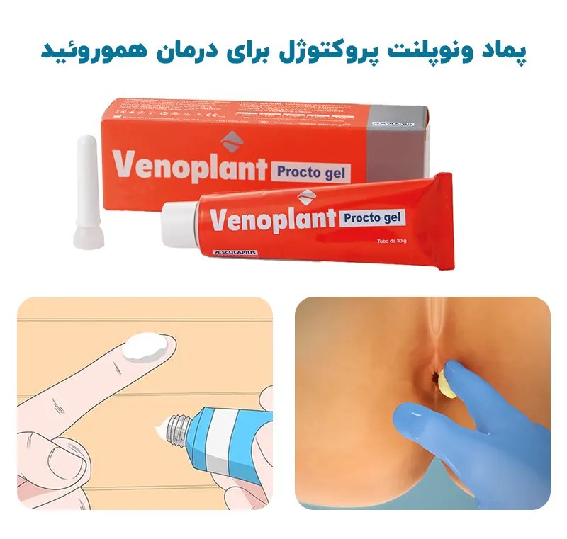 پماد ونوپلنت پروکتوژل برای درمان هموروئید