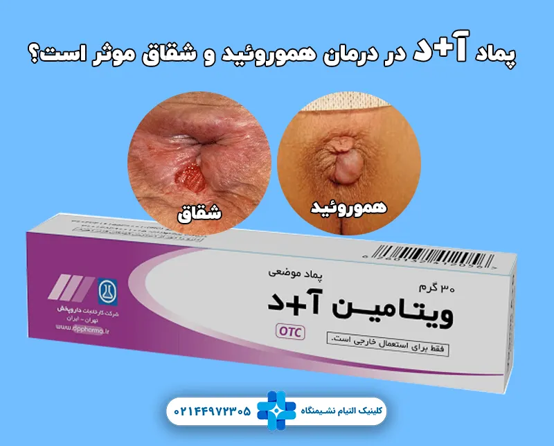 درمان هموروئید و شقاق با پماد آ+د