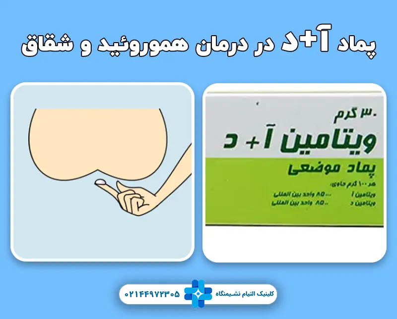 درمان هموروئید و شقاق با پماد آ+د
