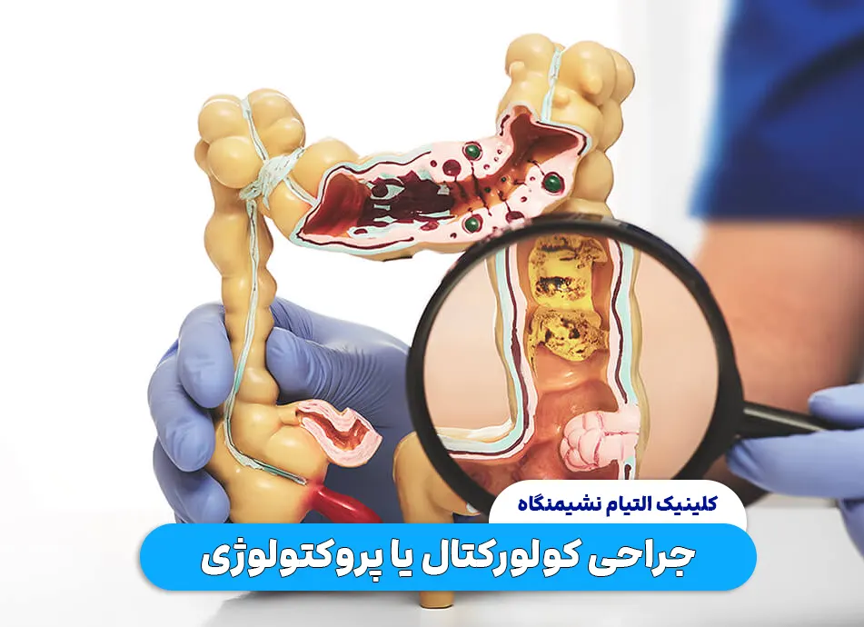 جراحی کولورکتال یا پروکتولوژی