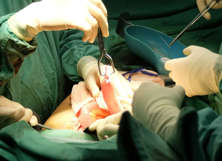 جراحی کولورکتال یا پروکتولوژی