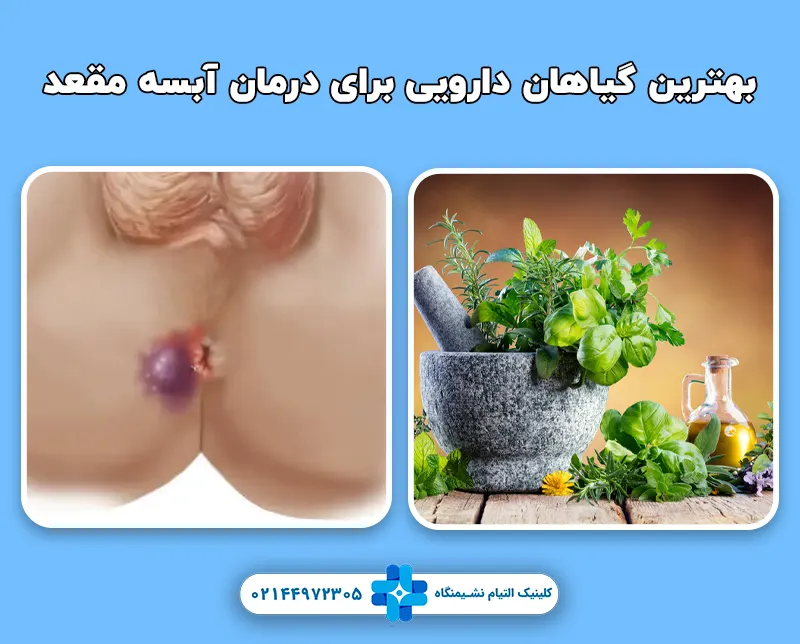 بهترین گیاهان دارویی برای درمان آبسه مقعد