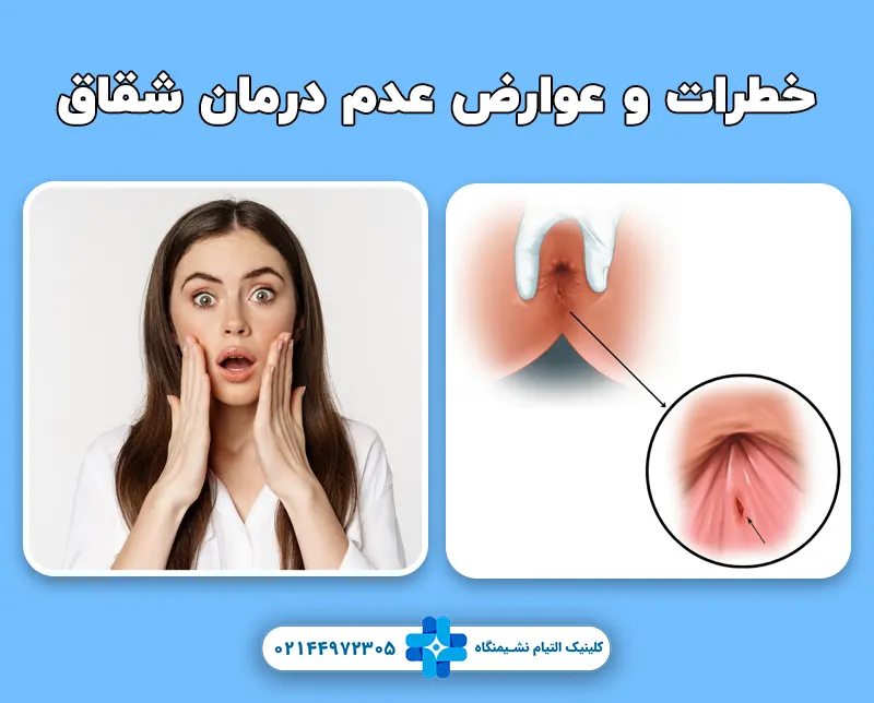خطرات و عوارض عدم درمان شقاق