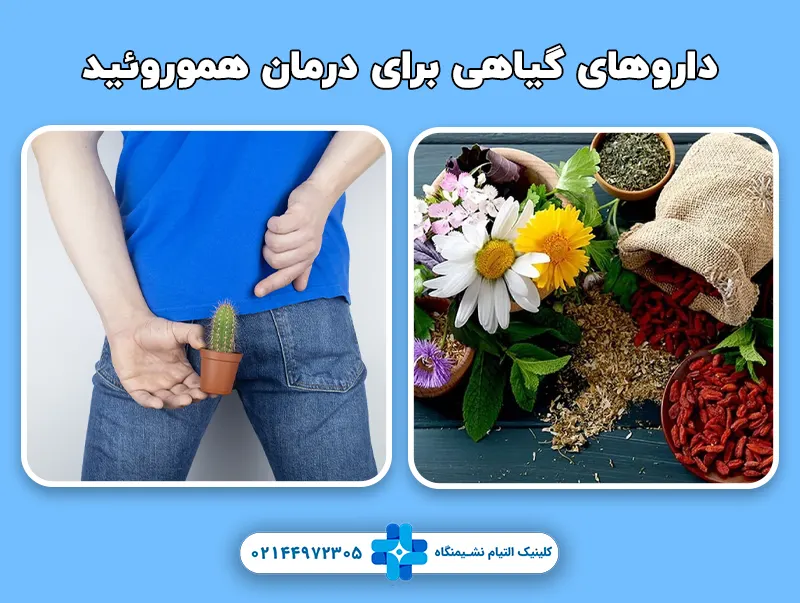 موثرترین داروهای گیاهی برای درمان هموروئید