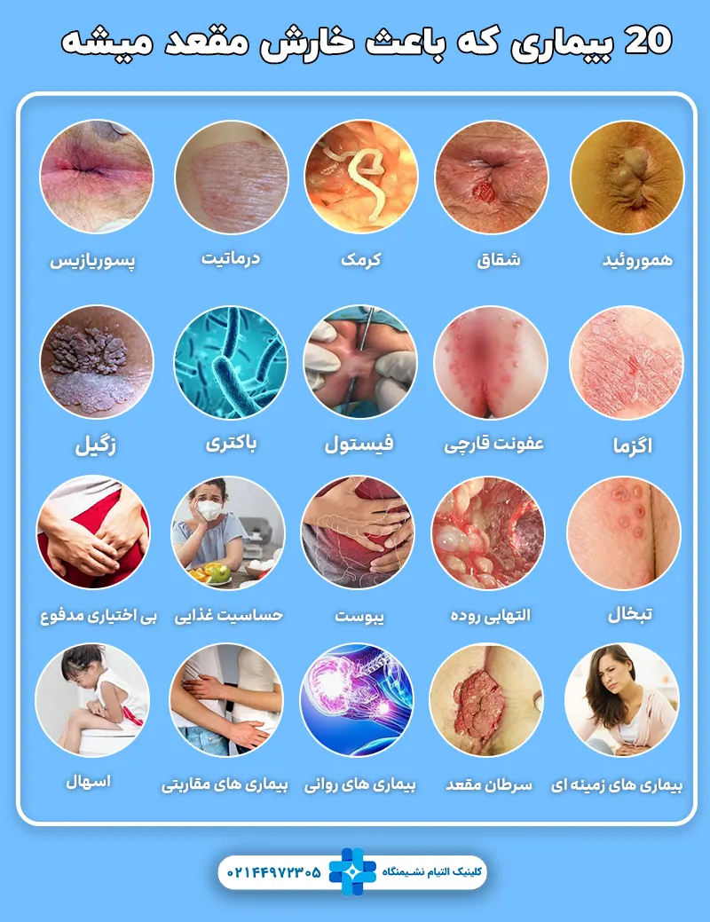 20 بیماری که باعث خارش مقعد میشه