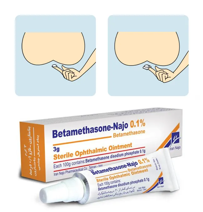 پماد بتامتازون برای درمان شقاق و همورئید