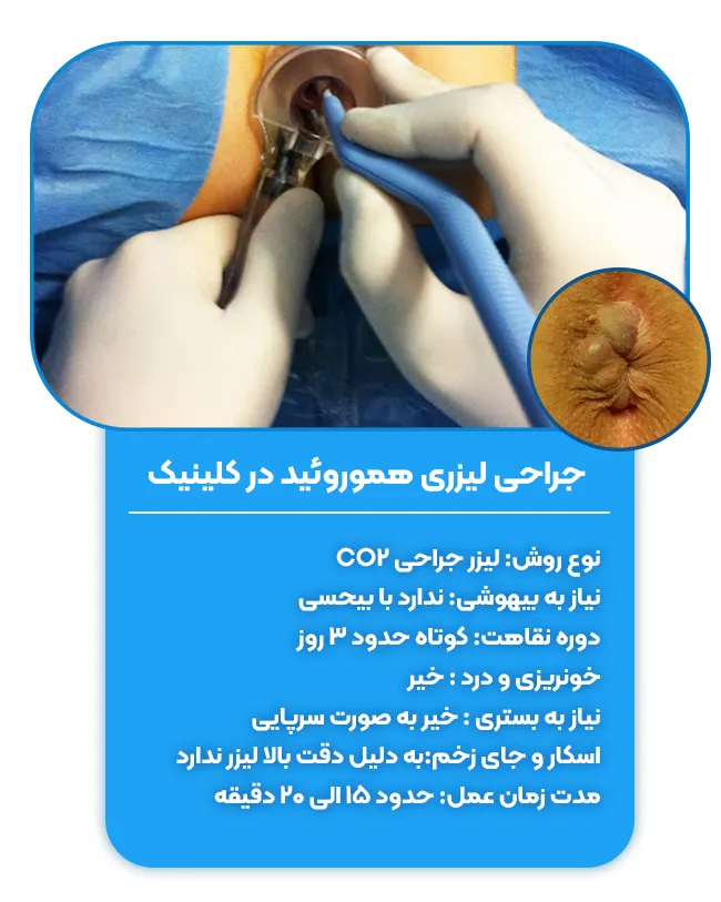 جراحی هموروئید در کلینیک