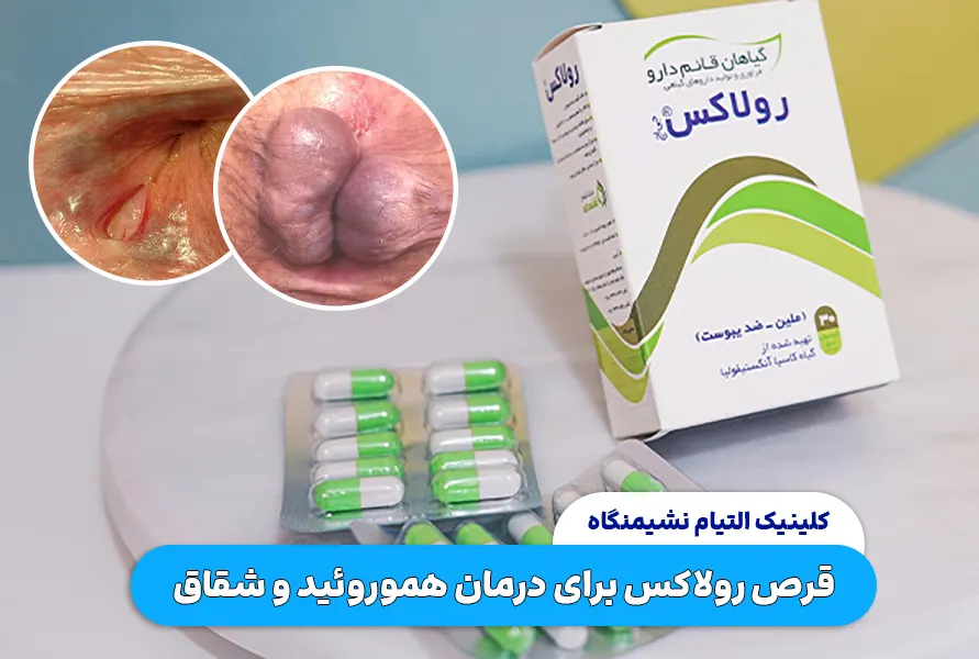 قرص رولاکس برای درمان هموروئید و شقاق