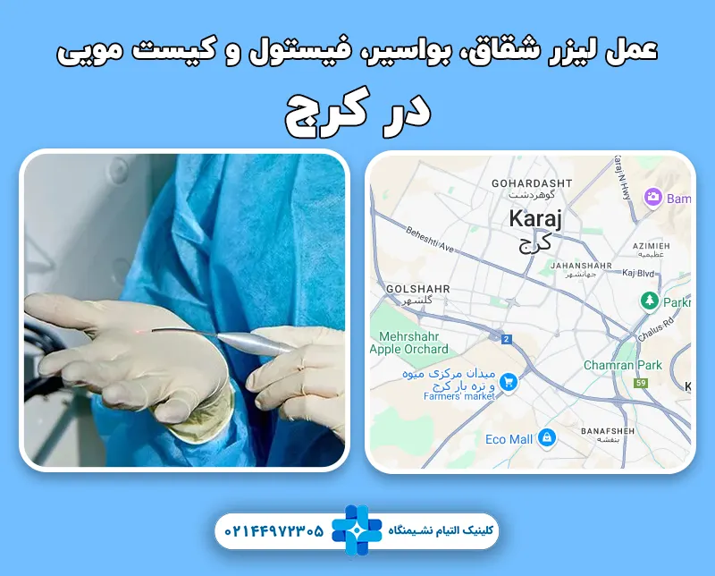 مرکز لیزر بیماری های شقاق، کیست مویی، فیستول در کرج