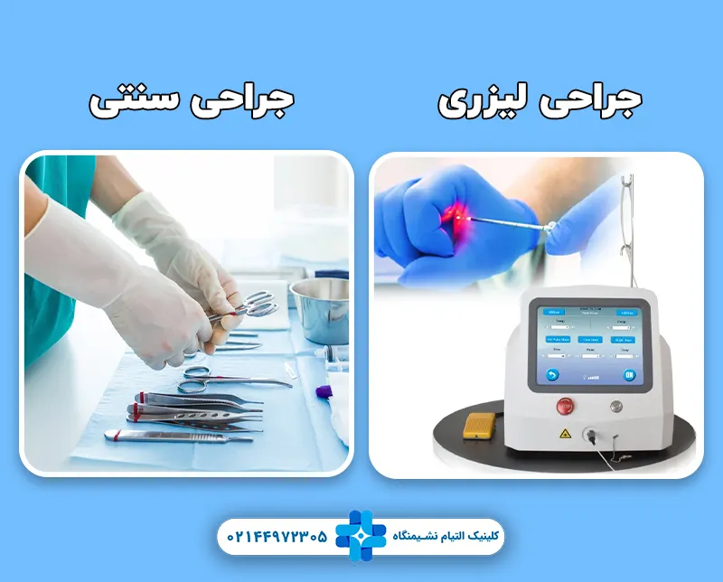 تفاوت لیزر و جراحی سنتی