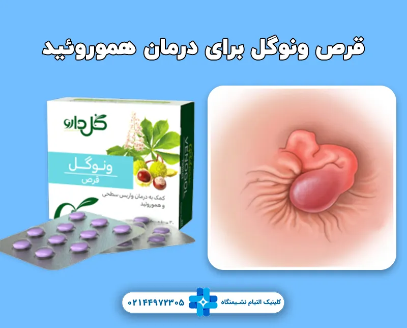 قرص ونوگل برای درمان هموروئید