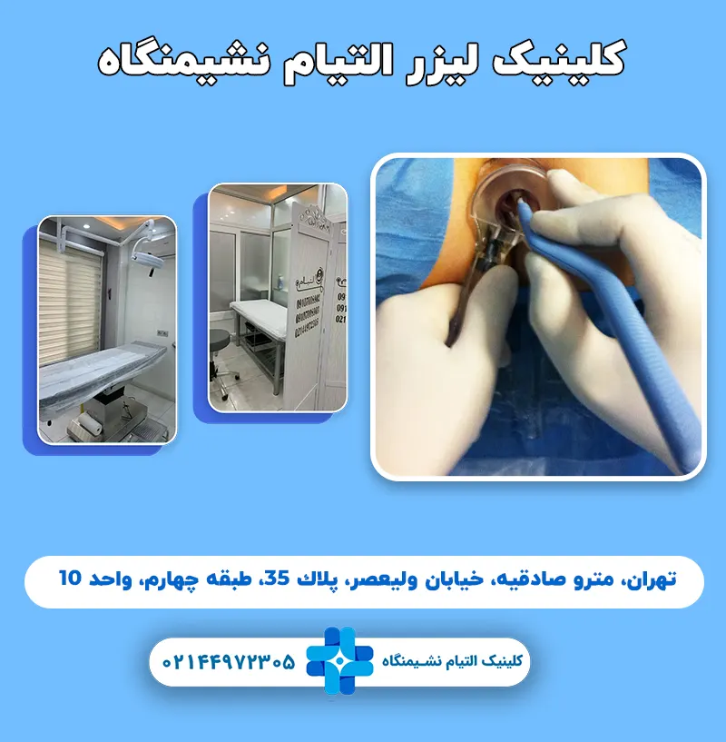 لیزر بیماری شقاق کیست مویی و فیستول در کرج