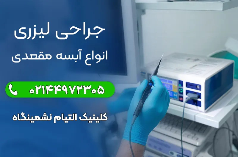 جراحی لیزر آبسه مقعد در کلینیک التیام نشیمنگاه تهران