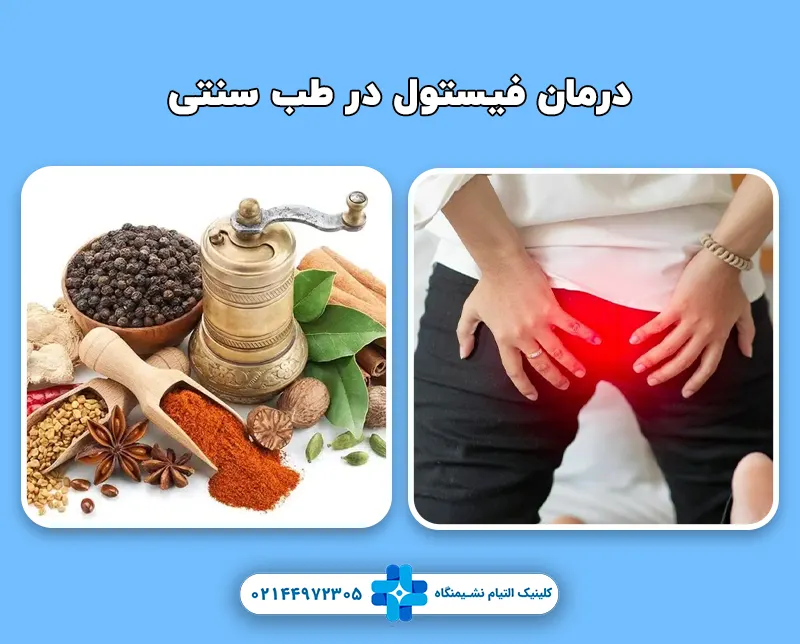 درمان فیستول در طب سنتی