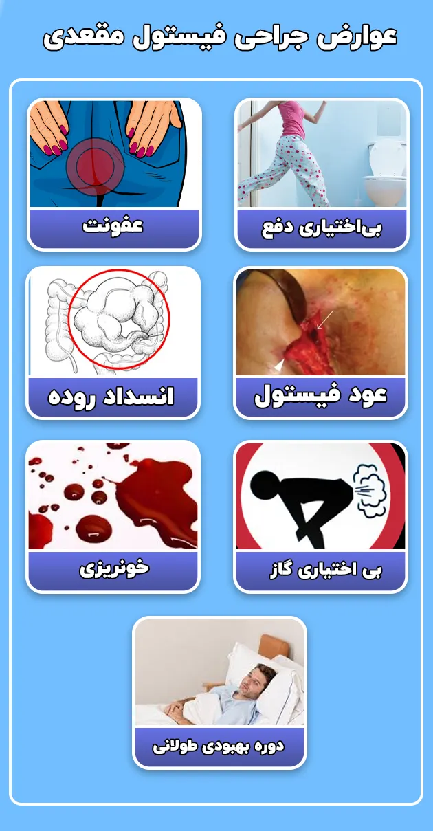 شایع ترین عوارض جراحی فیستول مقعدی