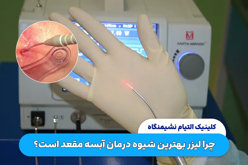 چرا لیزر بهترین شیوه درمان آبسه مقعد است؟