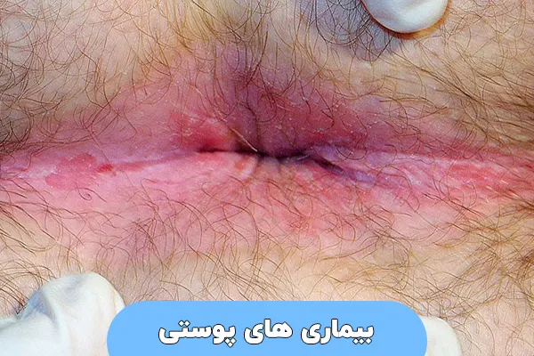 بیماری‌ های پوستی