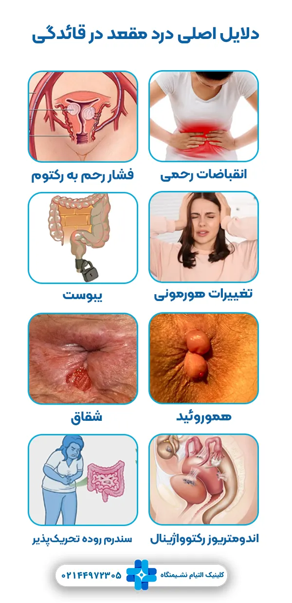 علل درد مقعدی در پریودی