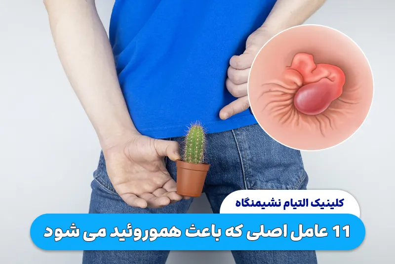 11 عامل که باعث هموروئید می شود را بشناسید