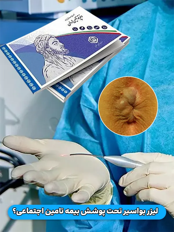 پوشش بیمه تامین اجتماعی لیزر بواسیر