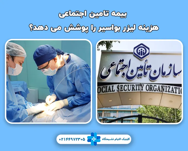 آیا بیمه تامین اجتماعی هزینه لیزر بواسیر را پوشش می دهد؟