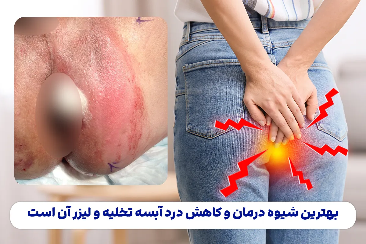 درد شدید آبسه مقعدی