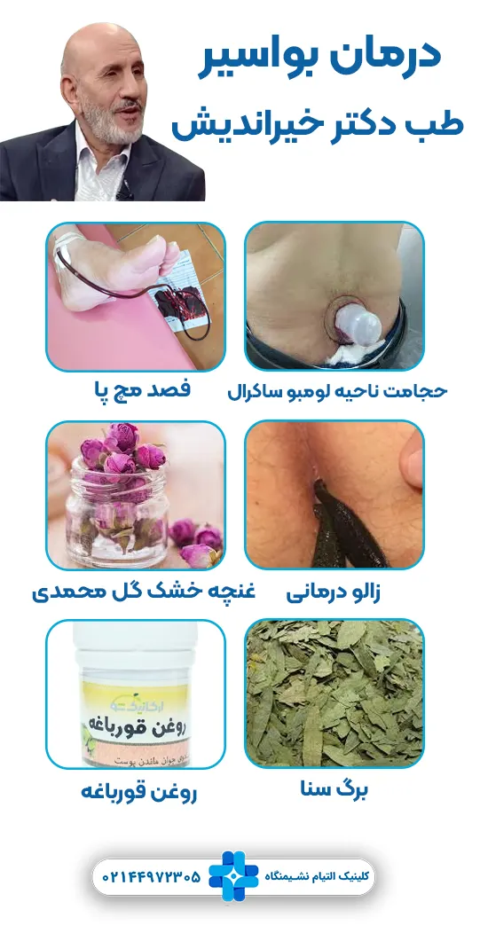درمان بواسیر دکتر خیراندیش