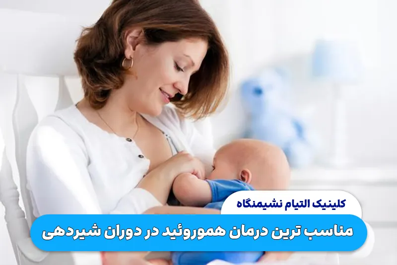 درمان هموروئید در دوران شیردهی