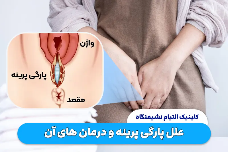 علل پارگی پرینه و درمان های آن