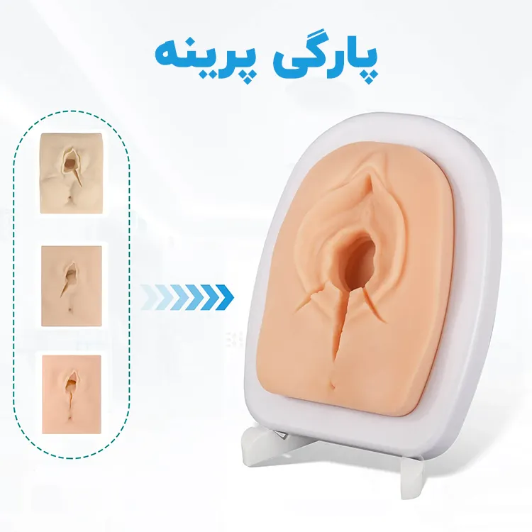 پارگی پرینه