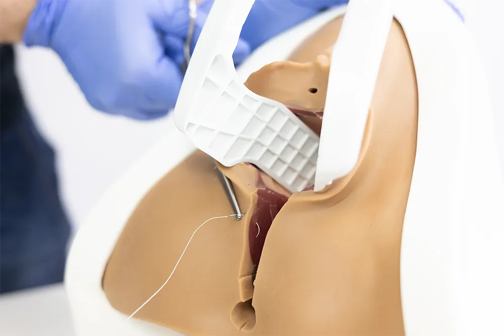 پارگی پرینه