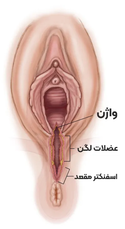 پارگی پرینه