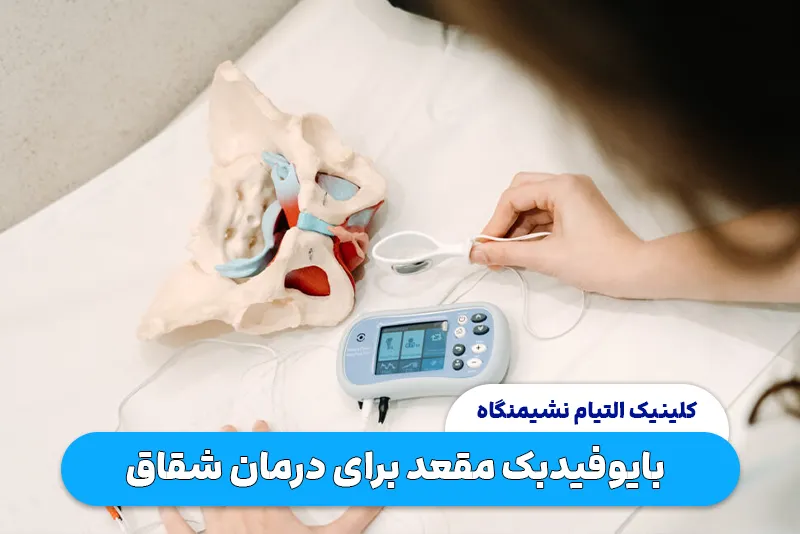 بایوفیدبک مقعد برای درمان شقاق