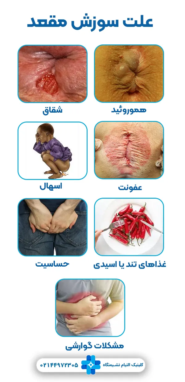 علت سوزش مقعد چیست؟