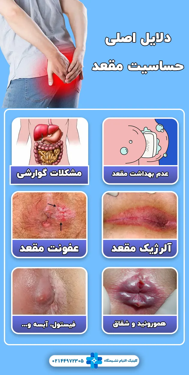 دلایل حساسیت مقعد